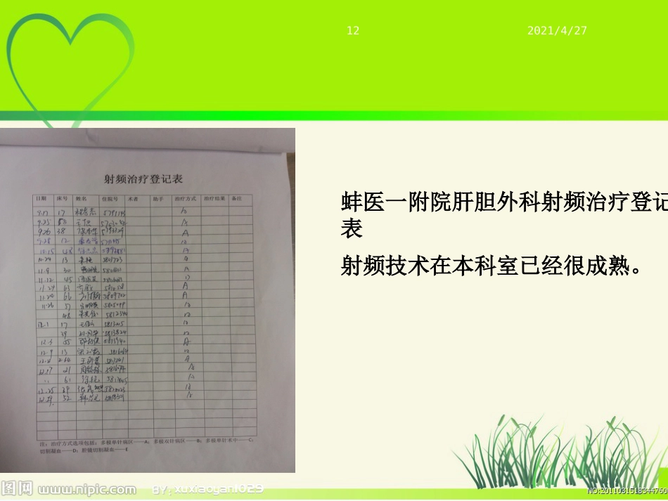 肝癌射频治疗_第12页