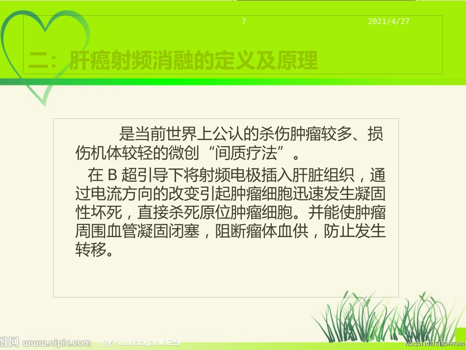 肝癌射频治疗_第7页
