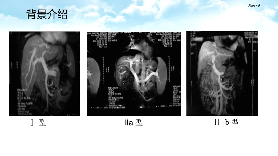 肝癌合并门静脉癌栓的综合治疗_第5页