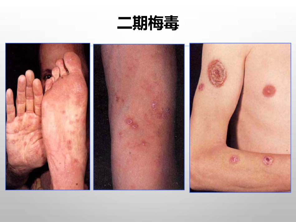 报告性病诊断标准_第10页