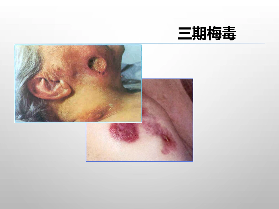 报告性病诊断标准_第12页