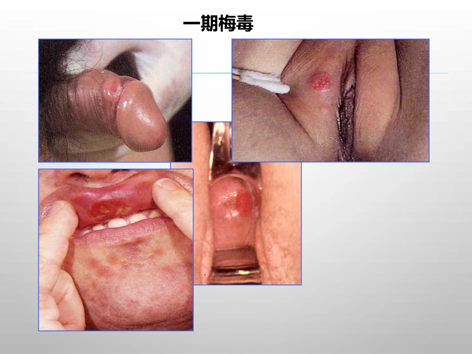 报告性病诊断标准_第8页