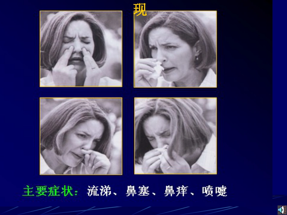 变应性过敏性鼻炎_第12页