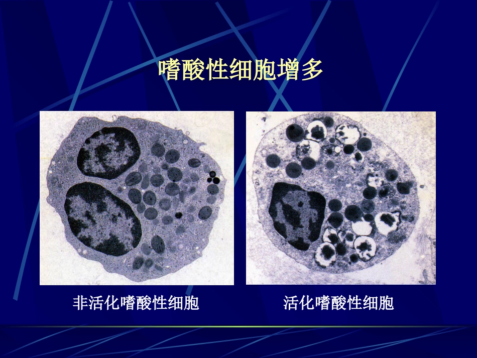 变应性过敏性鼻炎_第15页
