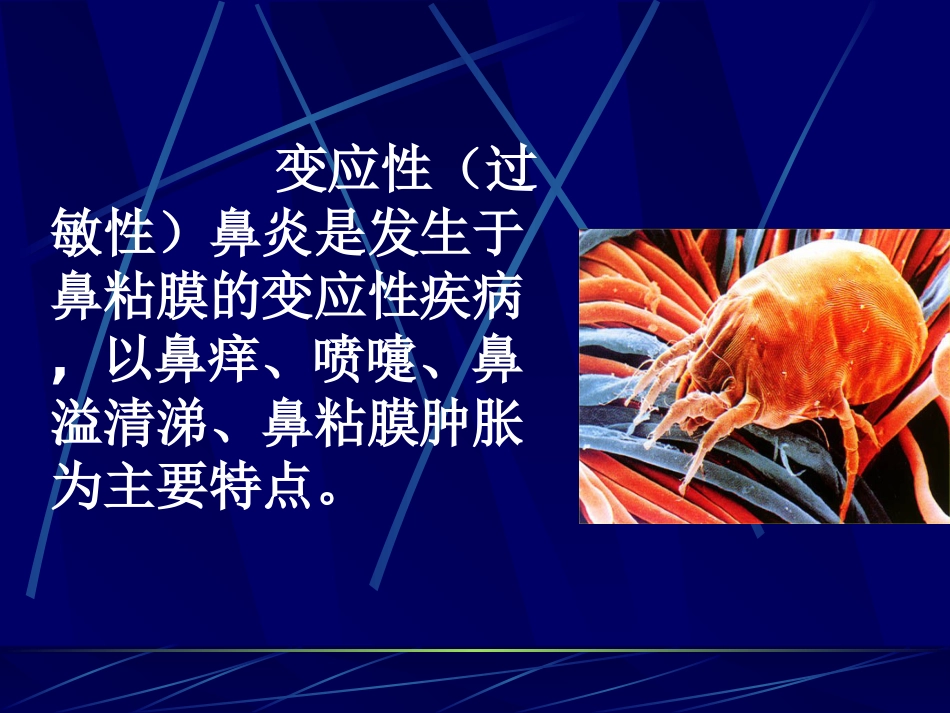 变应性过敏性鼻炎_第5页