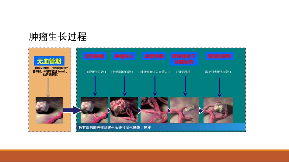 肝癌微创治疗 肝动脉化疗栓塞术(tace)_第7页