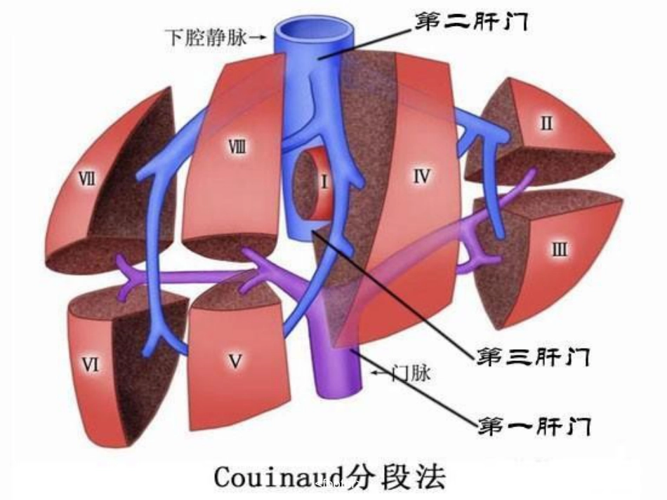 肝癌放射治疗_第5页