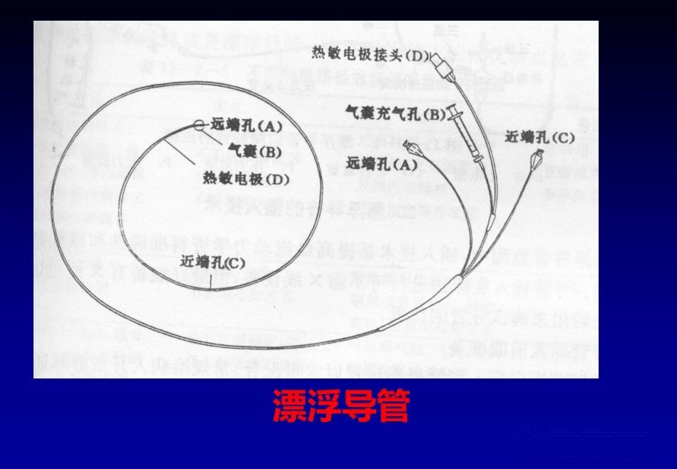 《心脏介入治疗》ppt课件_第1页