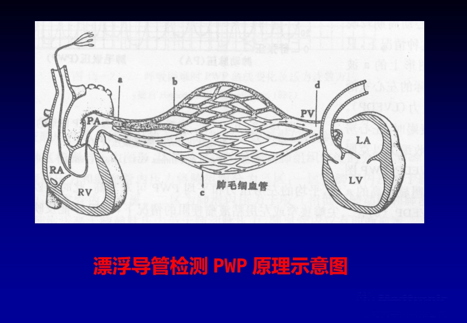 《心脏介入治疗》ppt课件_第3页