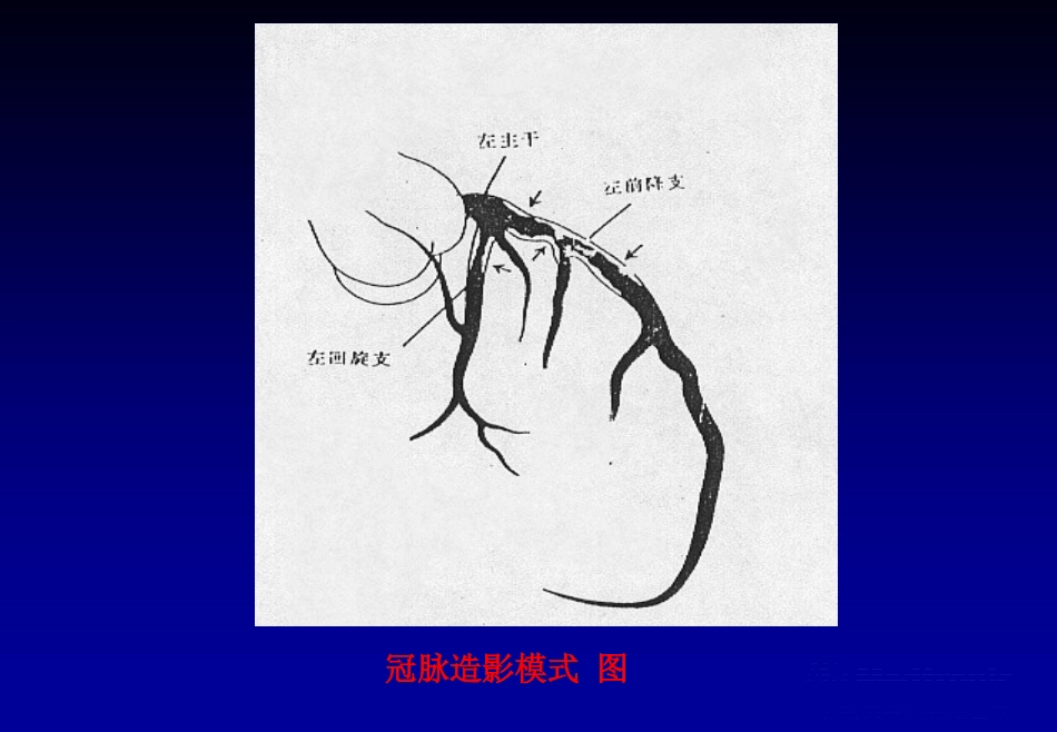 《心脏介入治疗》ppt课件_第7页