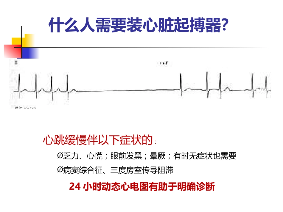 泛血管疾病介入诊疗_第13页
