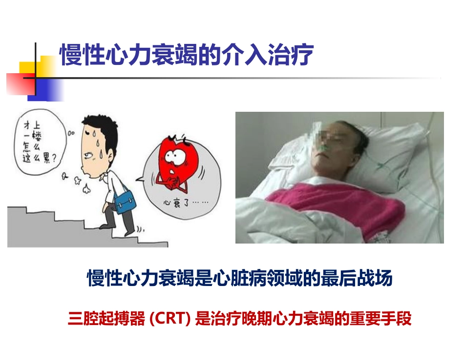 泛血管疾病介入诊疗_第15页