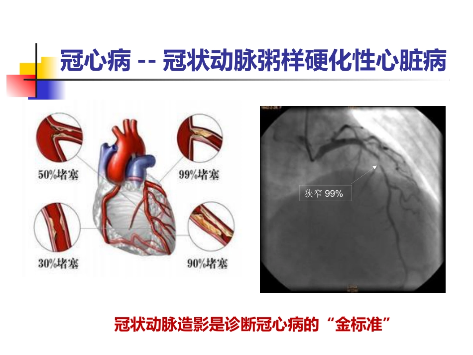 泛血管疾病介入诊疗_第6页