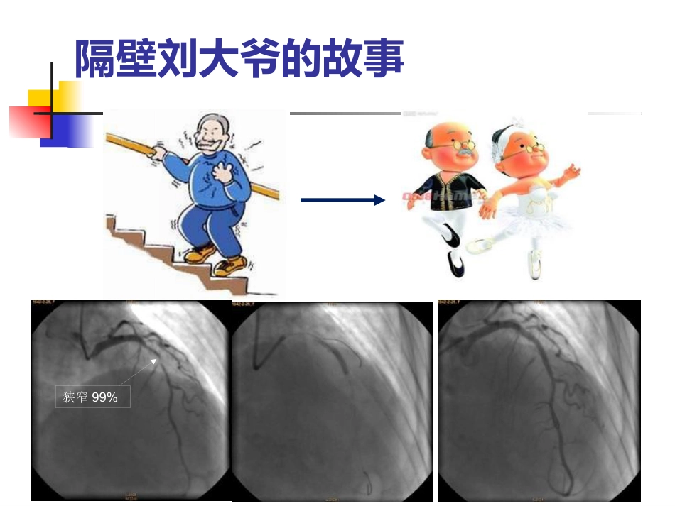 泛血管疾病介入诊疗_第7页