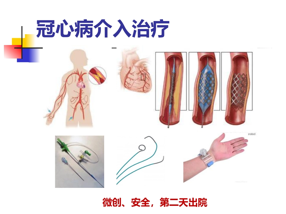 泛血管疾病介入诊疗_第8页