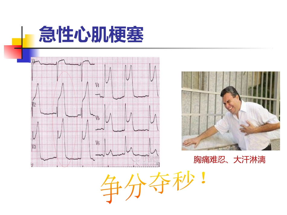 泛血管疾病介入诊疗_第9页