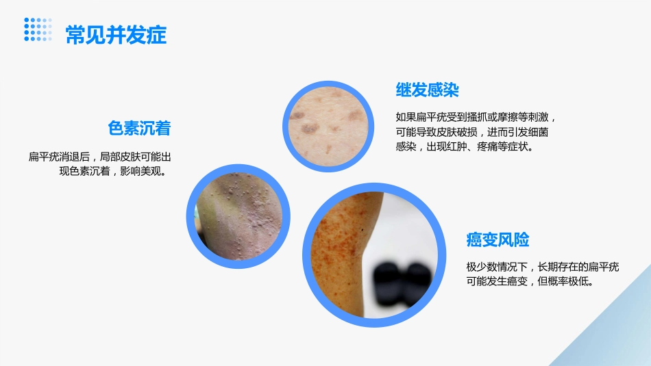 扁平疣教学演示课件_第12页