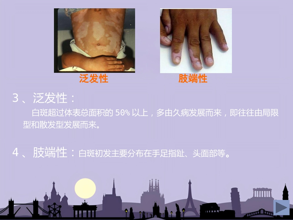 白癜风专业知识_第10页