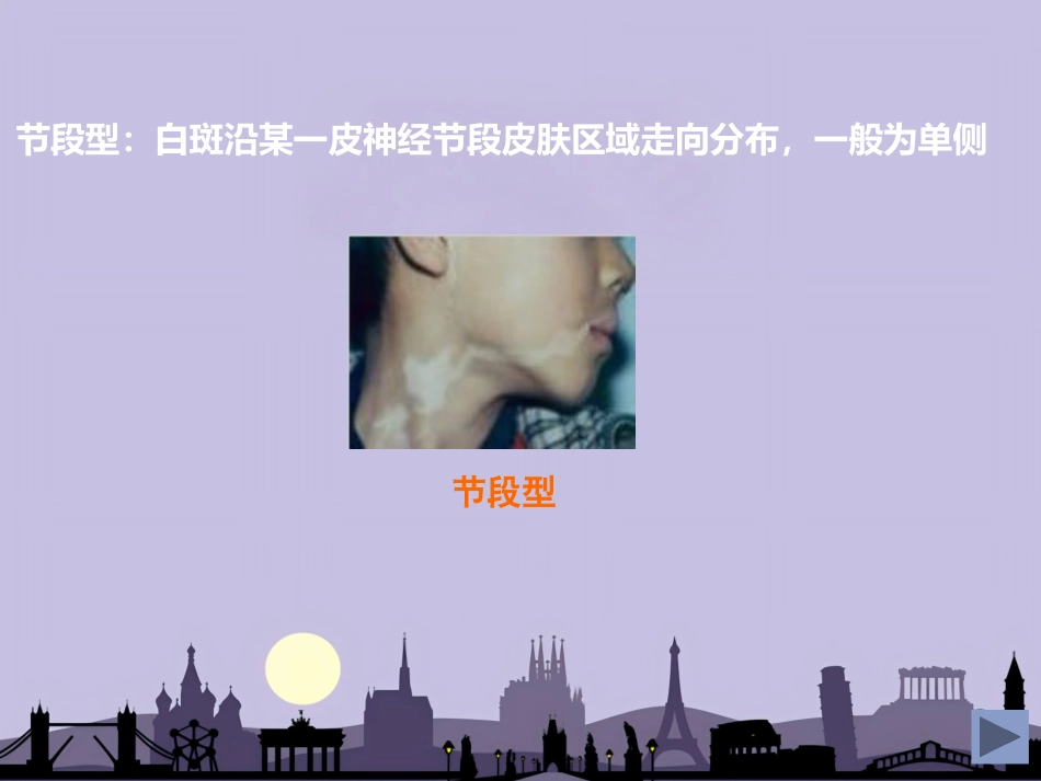 白癜风专业知识_第11页