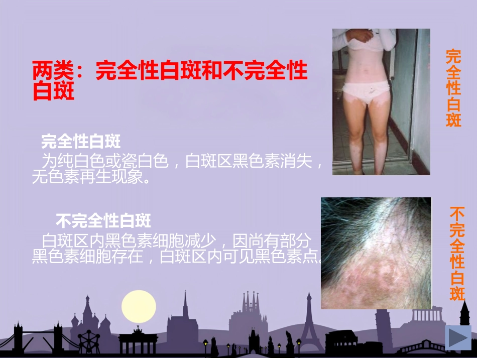 白癜风专业知识_第12页
