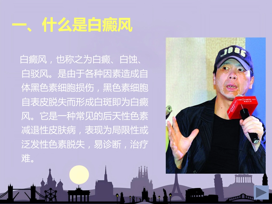 白癜风专业知识_第3页