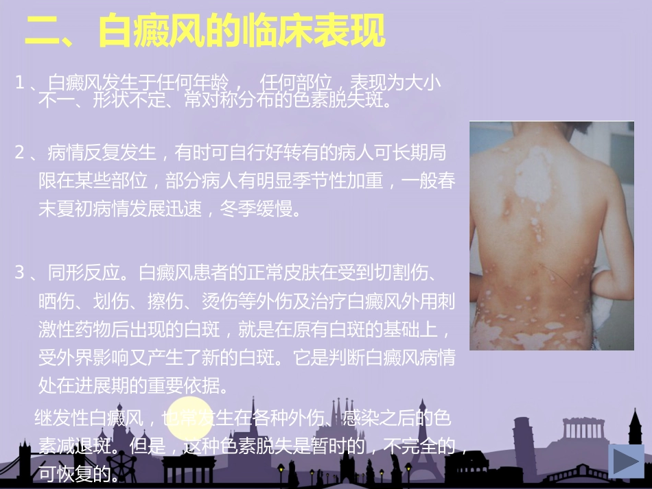 白癜风专业知识_第4页