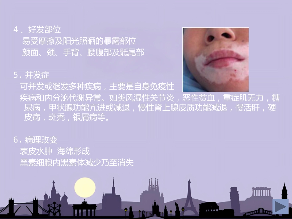 白癜风专业知识_第5页