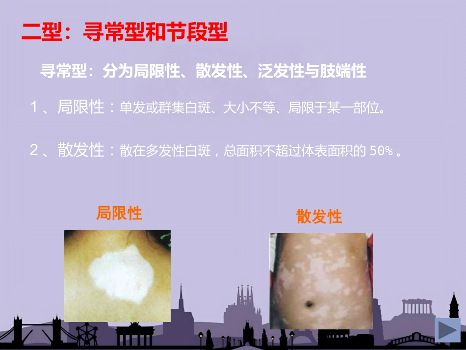 白癜风专业知识_第9页
