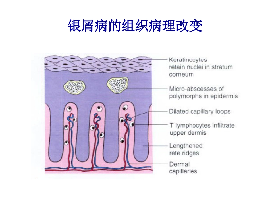 阿维A在皮肤科的应用_第4页