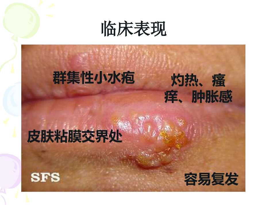 病毒性及细菌性皮肤病_第11页