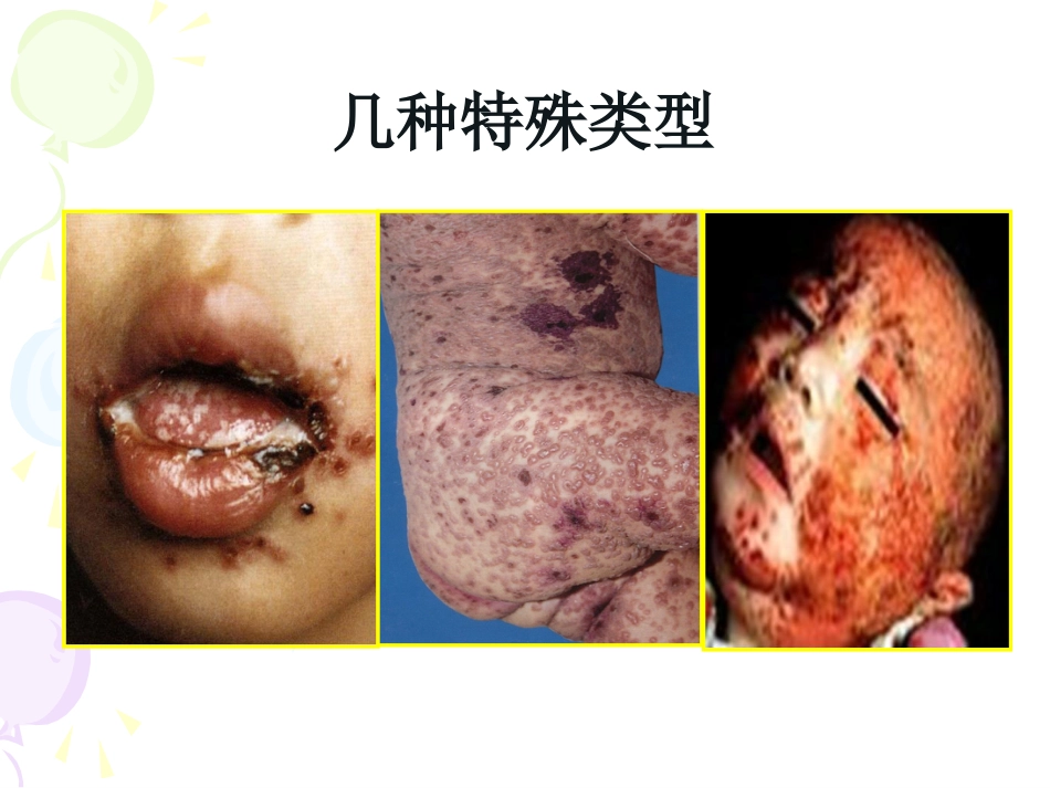 病毒性及细菌性皮肤病_第12页