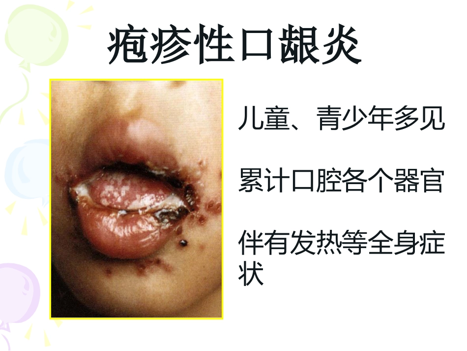 病毒性及细菌性皮肤病_第13页