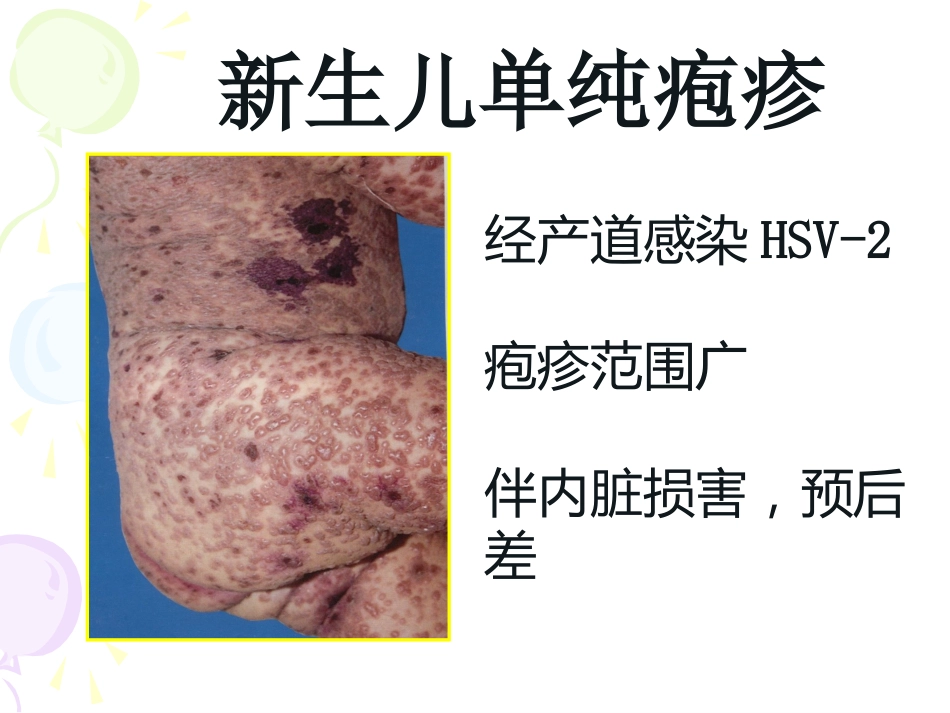 病毒性及细菌性皮肤病_第14页