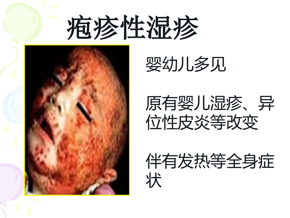 病毒性及细菌性皮肤病_第15页