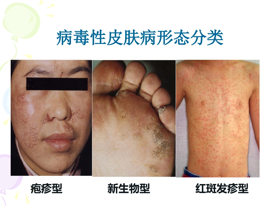 病毒性及细菌性皮肤病_第4页