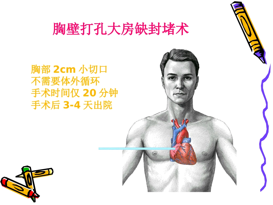 从介入医生角度论先心病合理化治疗_第8页