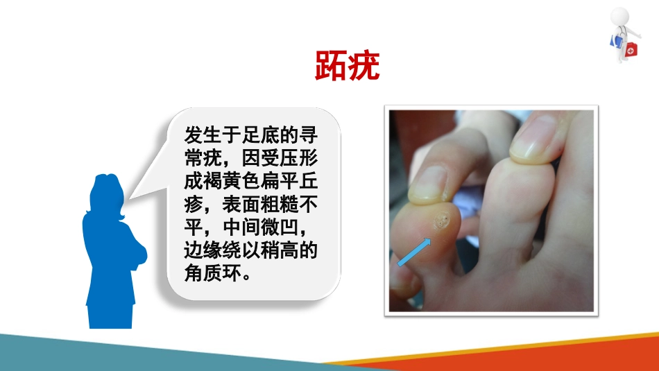 病毒性皮肤病—疣的诊疗(皮肤性病学课件)_第10页