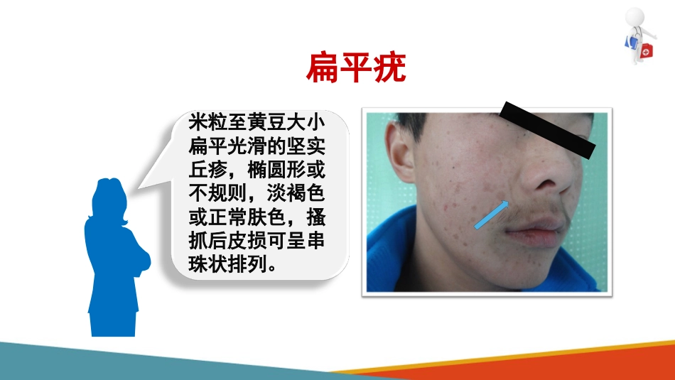 病毒性皮肤病—疣的诊疗(皮肤性病学课件)_第11页