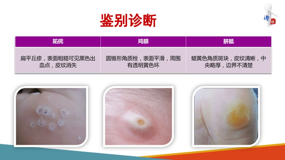 病毒性皮肤病—疣的诊疗(皮肤性病学课件)_第13页