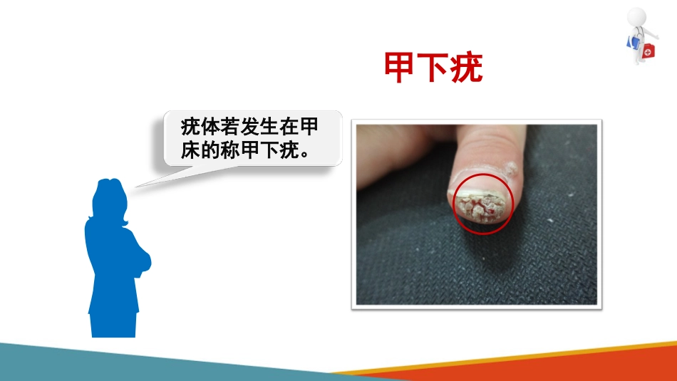 病毒性皮肤病—疣的诊疗(皮肤性病学课件)_第7页