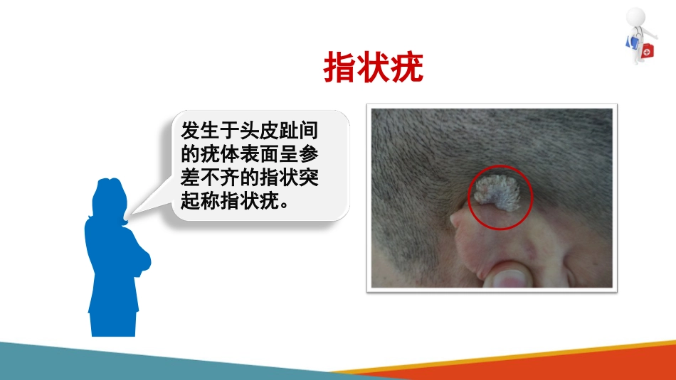 病毒性皮肤病—疣的诊疗(皮肤性病学课件)_第9页