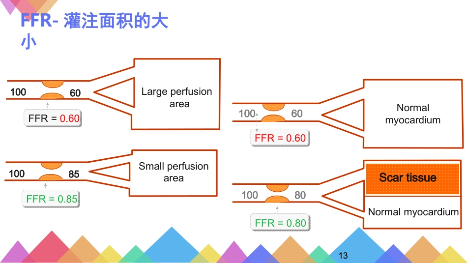 FFR优化冠心病介入治疗_第13页