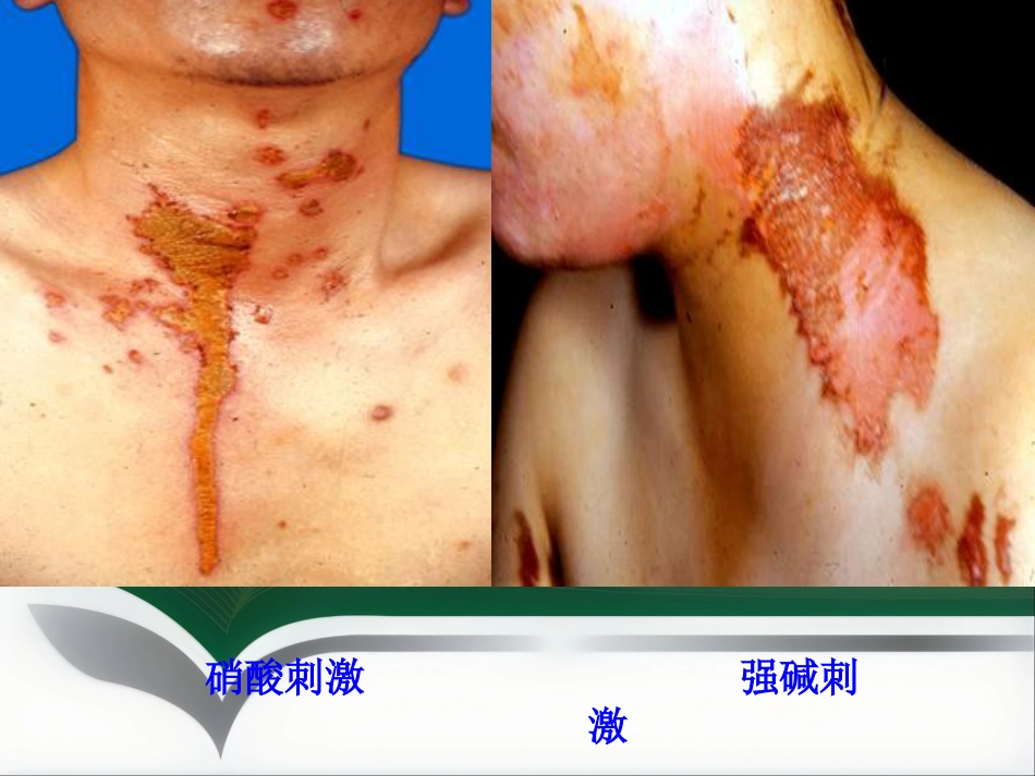 变态反应性皮肤病(1)_第8页