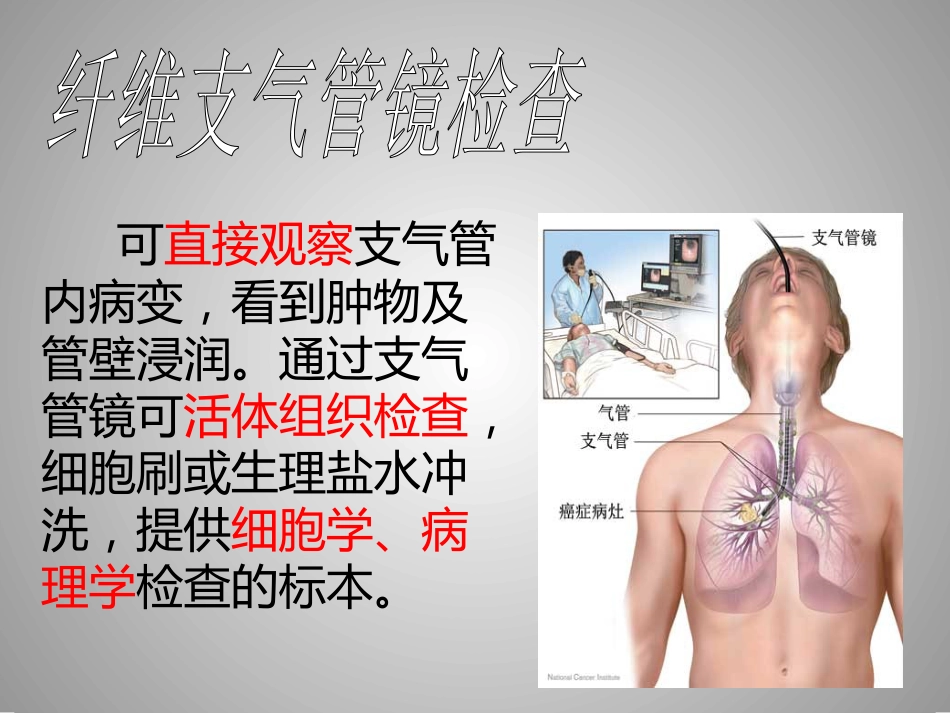 肺癌的介入诊疗技术_第7页