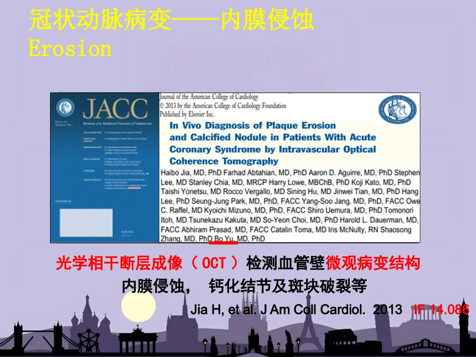 OCT在介入诊疗中的应用_第11页