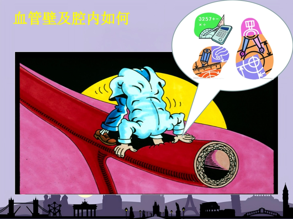 OCT在介入诊疗中的应用_第4页