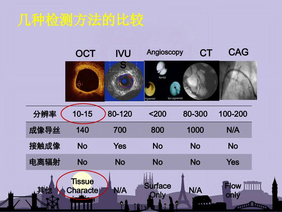 OCT在介入诊疗中的应用_第5页