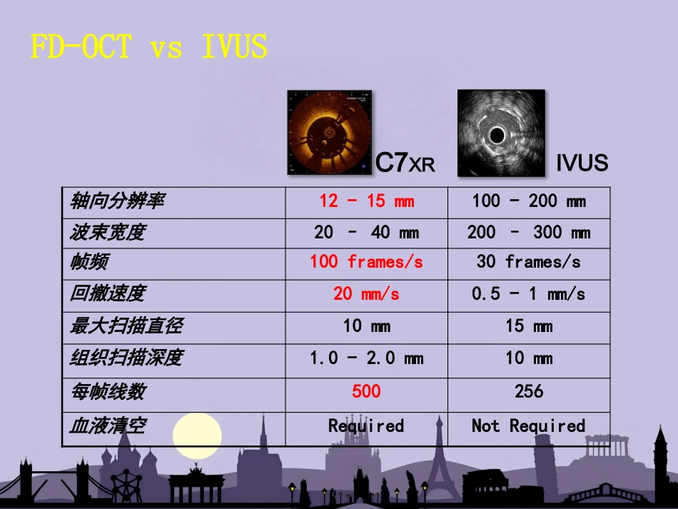 OCT在介入诊疗中的应用_第6页