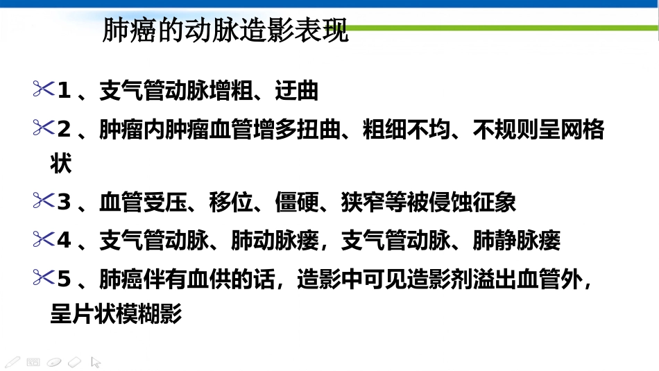 肺癌的动脉介入治疗_第10页
