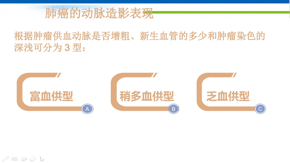 肺癌的动脉介入治疗_第9页